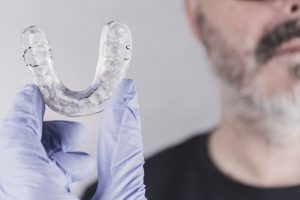 Bruxismo | Clínica Dental Ensanche de Vallecas