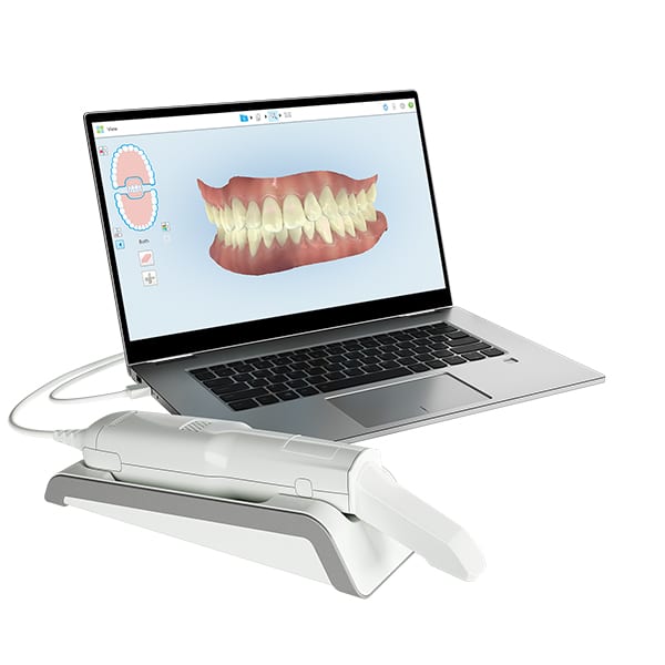 Escáner dental íTero | Clínica Dental Ensanche de Vallecas