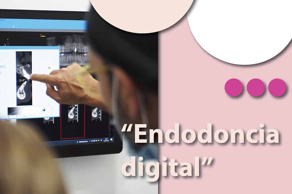 Endodoncia digital