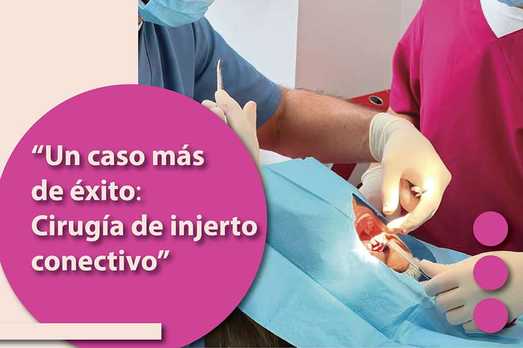 Un caso más de éxito en la Clínica Dental Ensanche de Vallecas: Cirugía de injerto conectivo