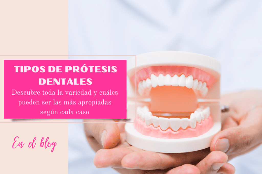 Tipos de prótesis dentales.