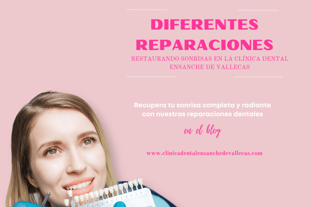 Conoce las diferentes reparaciones dentales: Restaurando sonrisas en la Clínica Dental Ensanche de Vallecas