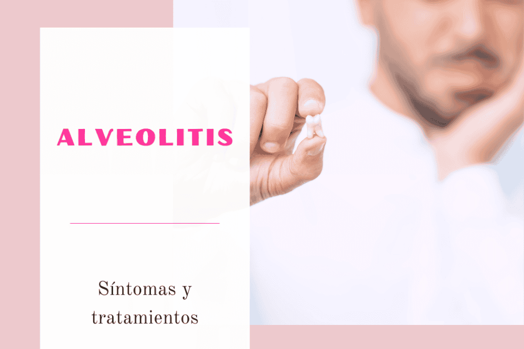 ¿Qué es la alveolitis?